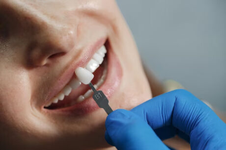 dentist-whiting-teeth_624325-1916